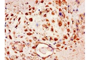 Immunohistochemistry of paraffin-embedded human placenta tissue using ABIN7151436 at dilution of 1:100 (FBLN4 Antikörper  (AA 26-165))