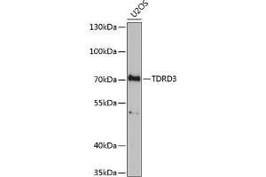 Western blot analysis of extracts of U2OS cells, using TDRD3 antibody (ABIN6133097, ABIN6148978, ABIN6148979 and ABIN6221657) at 1:1000 dilution. (TDRD3 Antikörper  (AA 1-220))