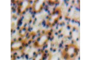 IHC-P analysis of Kidney tissue, with DAB staining. (TGFB1I1 Antikörper  (AA 252-390))
