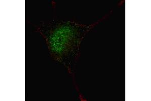 Fluorescent confocal image of SY5Y cells stained with phospho-STAT3- antibody. (STAT3 Antikörper  (pSer727))