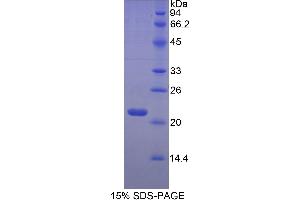 SDS-PAGE (SDS) image for Hemoglobin beta (HBB) (AA 1-147) protein (His tag) (ABIN2123836) (Hemoglobin Subunit beta Protein (AA 1-147) (His tag))