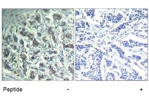 Image no. 1 for anti-phospholipase C, gamma 1 (PLCG1) (Tyr771) antibody (ABIN319399) (Phospholipase C gamma 1 Antikörper  (Tyr771))