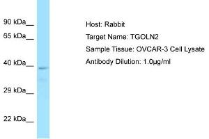 Host: Rabbit Target Name: TGOLN2 Sample Tissue: Human OVCAR-3 Whole Cell Antibody Dilution: 1ug/ml (TGOLN2 Antikörper  (C-Term))