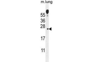 Western Blotting (WB) image for anti-Vesicular, Overexpressed in Cancer, Prosurvival Protein 1 (VOPP1) antibody (ABIN2996076) (VOPP1 Antikörper)