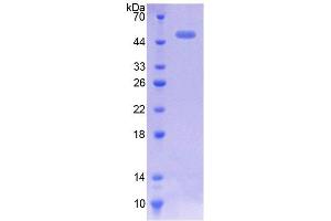 SDS-PAGE analysis of Mouse CACNa1H Protein. (CACNA1H Protein)