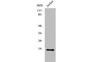 Western Blot analysis of MCF7 cells using Neuromedin-S Polyclonal Antibody (NMS Antikörper  (C-Term))