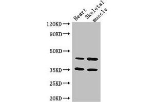 Western Blot Positive WB detected in: Mouse heart tissue, Mouse skeletal muscle tissue All lanes: ACTL9 antibody at 3. (ACTL9 Antikörper  (AA 1-160))