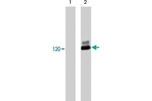 Western blot analysis of human Jurkat cells untreated (lane 1) or treated with pervanadate (1 mM) for 30 minutes (lane 2).