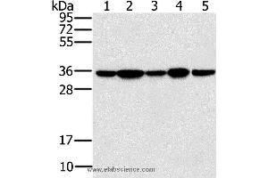 Western blot analysis of Jurkat, 293T and hela cell, mouse brain tissue and K562 cell, using PPP1CC Polyclonal Antibody at dilution of 1:200