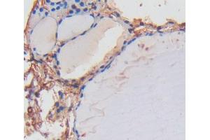 IHC-P analysis of thyroid tissue, with DAB staining. (LRP1B Antikörper  (AA 31-194))