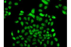 Immunofluorescence analysis of A549 cell using FBXO7 antibody.