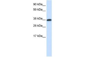 WB Suggested Anti-DMRTC2 Antibody Titration:  0.