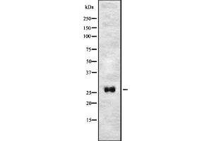 Western blot analysis of T106C expression in HEK293 cells ,The lane on the left is treated with the antigen-specific peptide. (TMEM106C Antikörper  (Internal Region))