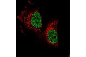 Immunofluorescent staining of human cell line U-251 MG with PARPBP polyclonal antibody  at 1-4 ug/mL dilution shows positivity in nucleus but not nucleoli.