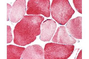 Immunohistochemistry (IHC) image for anti-Potassium Inwardly-Rectifying Channel, Subfamily J, Member 12 (KCNJ12) (AA 360-409) antibody (ABIN6755283)