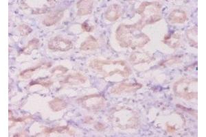 Immunohistochemistry of paraffin-embedded human kidney tissue using ABIN7145472 at dilution of 1:50 (beta Defensin 1 Antikörper  (AA 33-68))