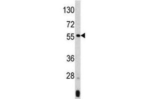 Western blot analysis of ANGPTL3 antibody and mouse liver tissue lysate. (ANGPTL3 Antikörper  (AA 82-114))