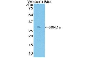 Western Blotting (WB) image for anti-B-Cell CLL/lymphoma 3 (BCL3) (AA 127-376) antibody (ABIN1858125)