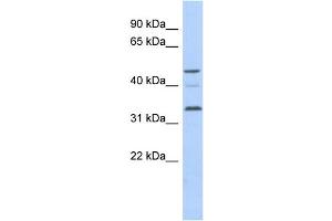 WB Suggested Anti-CCNYL1 Antibody Titration: 0. (CCNYL1 Antikörper  (N-Term))