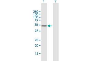 Western Blot analysis of FOXD4L1 expression in transfected 293T cell line by FOXD4L1 MaxPab polyclonal antibody.