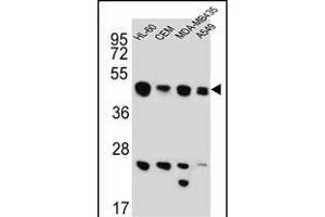 BIN2 Antibody (N-term) (ABIN651965 and ABIN2840476) western blot analysis in HL-60,CEM,MDA-M,A549 cell line lysates (15 μg/lane). (BIN2 Antikörper  (N-Term))