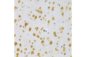 Immunohistochemistry of paraffin-embedded mouse brain using MDM2 Antibody  at dilution of 1:200 (40x lens). (MDM2 Antikörper  (AA 130-230))