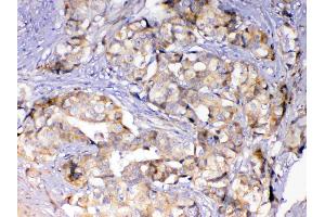 IHC analysis of Adenylosuccinate Lyase using anti-Adenylosuccinate Lyase antibody . (ASL Antikörper)