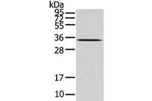 Western Blot analysis of Mouse liver tissue using UCP2 Polyclonal Antibody at dilution of 1/200 (UCP2 Antikörper)