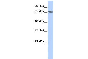 WB Suggested Anti-SDCCAG8 Antibody Titration: 0. (SDCCAG8 Antikörper  (Middle Region))