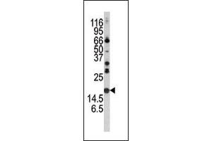 Western blot analysis of anti-Alpha-synuclein Pab (ABIN390368 and ABIN2840773) in mouse brain tissue lysate. (SNCA Antikörper  (C-Term))