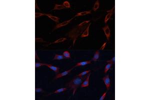Immunofluorescence analysis of NIH/3T3 cells using Src antibody (ABIN6132240, ABIN6148428, ABIN6148429 and ABIN6215399) at dilution of 1:100. (Src Antikörper  (AA 1-80))