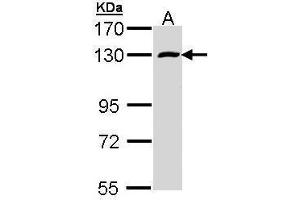 WB Image Sample (30 ug of whole cell lysate) A: A431 , 7. (RBM15 Antikörper)