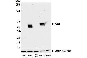 Western Blotting (WB) image for anti-CD5 (CD5) (AA 25-371) antibody (ABIN7449418)