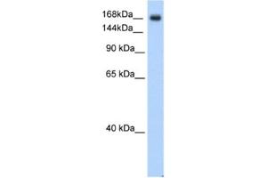 Western Blotting (WB) image for anti-Sodium Channel, Voltage-Gated, Type V, alpha Subunit (SCN5A) antibody (ABIN2461170)