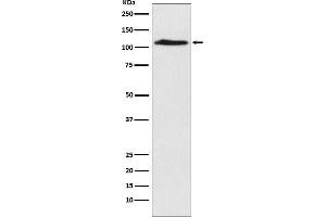 Western blot analysis of CHD1L expression in A549 cell lysate.