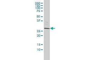 SMNDC1 monoclonal antibody (M01), clone 2B9 Western Blot analysis of SMNDC1 expression in Jurkat . (SMNDC1 Antikörper  (AA 1-238))