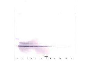 Image no. 3 for anti-Platelet Factor 4 (PF4) antibody (ABIN465152) (PF4 Antikörper)