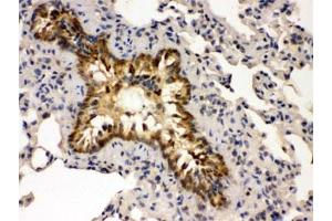 IHC testing of FFPE mouse lung with GRK5 antibody.