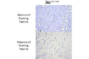 Immunohistochemistry analysis of a competition assay demonstrating the specificity of the anti-Tau (Ser 208/210) antibody (tau Antikörper  (pSer208, pSer210))