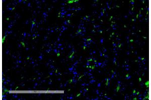 Immunohistochemistry analysis using Mouse Anti-VPS35 Monoclonal Antibody, Clone 8A3 (ABIN6932977). (VPS35 Antikörper  (PerCP))