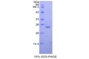 SDS-PAGE (SDS) image for Sialic Acid Binding Ig-Like Lectin 12 (SIGLEC12) (AA 22-218) protein (His tag) (ABIN2122081)