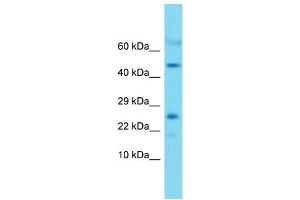 Western Blotting (WB) image for anti-Mitochondrial Ribosomal Protein L22 (MRPL22) (Middle Region) antibody (ABIN2789277) (MRPL22 Antikörper  (Middle Region))