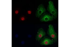 ABIN7093962 and ABIN7098006 staining Hela cells by IF/ICC. (PRPF4 Antikörper  (Internal Region))