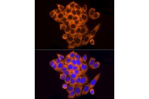 Immunofluorescence analysis of HeLa cells using RPL10A Rabbit mAb (ABIN7269992) at dilution of 1:100 (40x lens).