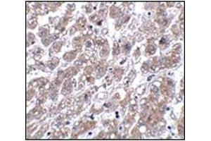 Immunohistochemistry of MATN1 in human liver tissue with this product at 5 μg/ml.