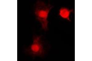 Immunofluorescent analysis of SNAI1 staining in HEK293T cells. (SNAIL Antikörper  (C-Term))