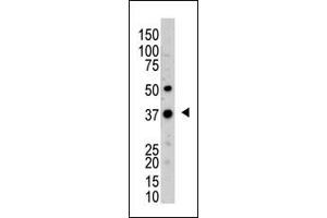 The anti-UCHL5 Pab (ABIN388873 and ABIN2839168) is used in Western blot to detect UCHL5 in mouse kidney tissue lysate. (UCHL5 Antikörper  (N-Term))