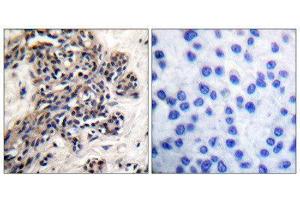 Immunohistochemistry (IHC) image for anti-Heat Shock Protein 90kDa alpha (Cytosolic), Class B Member 1 (HSP90AB1) (pSer254) antibody (ABIN1847211) (HSP90AB1 Antikörper  (pSer254))