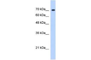 JMJD3 antibody (20R-1248) used at 0. (Kdm6b Antikörper  (Middle Region))