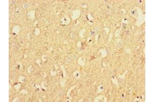 Immunohistochemistry of paraffin-embedded human brain tissue using ABIN7167338 at dilution of 1:100 (RAB4B Antikörper  (AA 1-278))